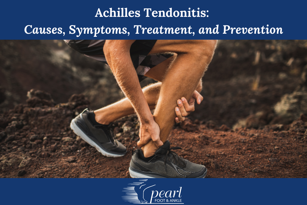 Achilles Tendonitis Causes, Symptoms, Treatment, and Prevention
