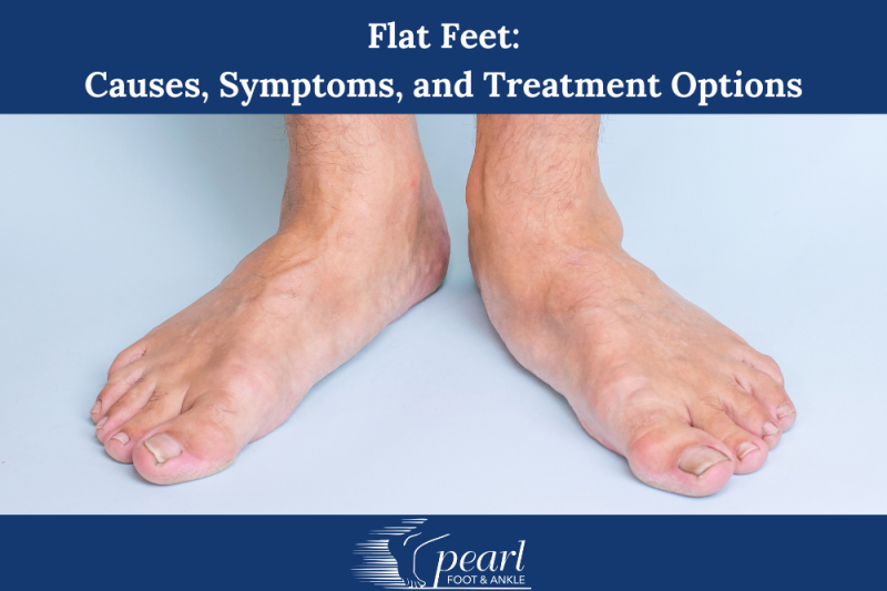 Flat Feet Causes, Symptoms, and Treatment Options