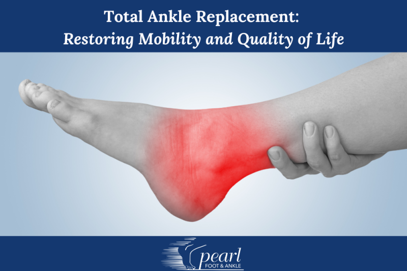 Total Ankle Replacement Restoring Mobility and Quality of Life